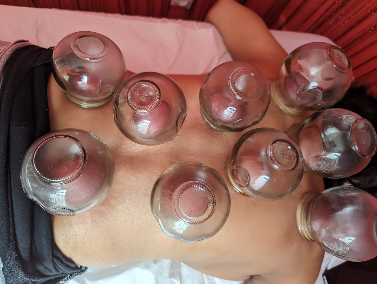 Ventouses en verre posées sur le dos, au salon Jia Xing
